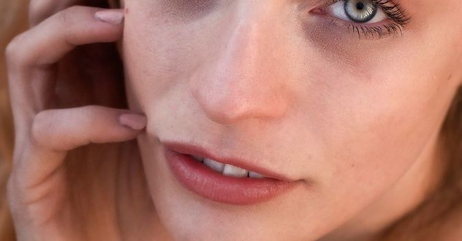 Dark Under-Eye Circles & Puffiness