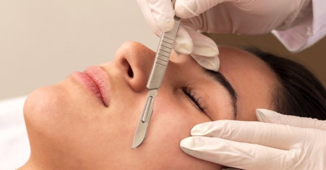 Dermaplaning