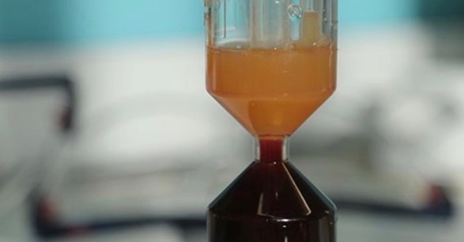PRP (Platelet-Rich Plasma)